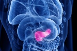Rise of pancreatic cancer diagnoses might reflect increased early detection