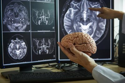 Scientists discover way to deliver medicines across brain's protective barrier