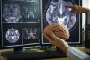 Scientists discover way to deliver medicines across brain's protective barrier